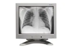 Medical Imaging Monitor