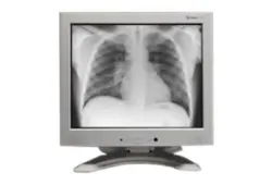 Medical Imaging Monitor